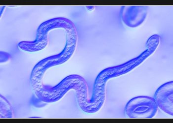 Texas Woman Suffers Blindness Due to Contact Lenses Causing Parasitic Infection