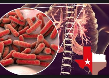 The Emergence of a Dangerous 'Old World' Illness as a Growing Concern in Texas