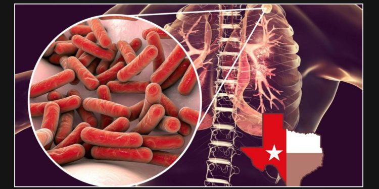 The Emergence of a Dangerous 'Old World' Illness as a Growing Concern in Texas