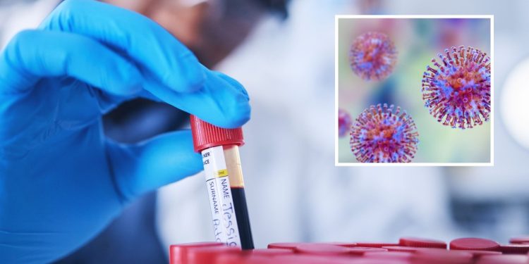 Hundreds of Vials of Deadly Viruses Missing After Lab Breach