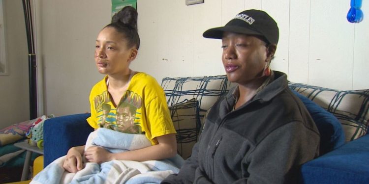 Arlington Teenager Shares Harrowing Moment When Friends Beat Her And Left On The Side Of The Road