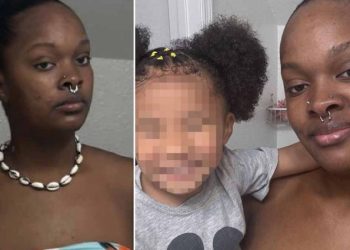 Child Was Left In Serious Condition After Her Parent Caused More Than Two Dozen Injuries On Her Body By Taking The Girl’s Hand And Bringing Her To A Neighboring Hallway Where She Stabbed Her