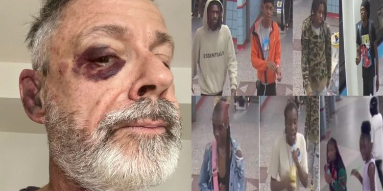 Chicago Man Brutally Beaten by Teenagers on CTA Orange Line